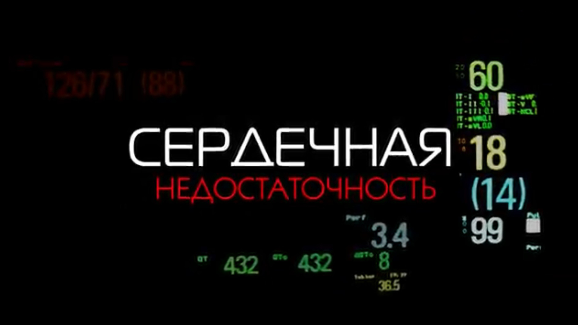 Сердечная недостаточность