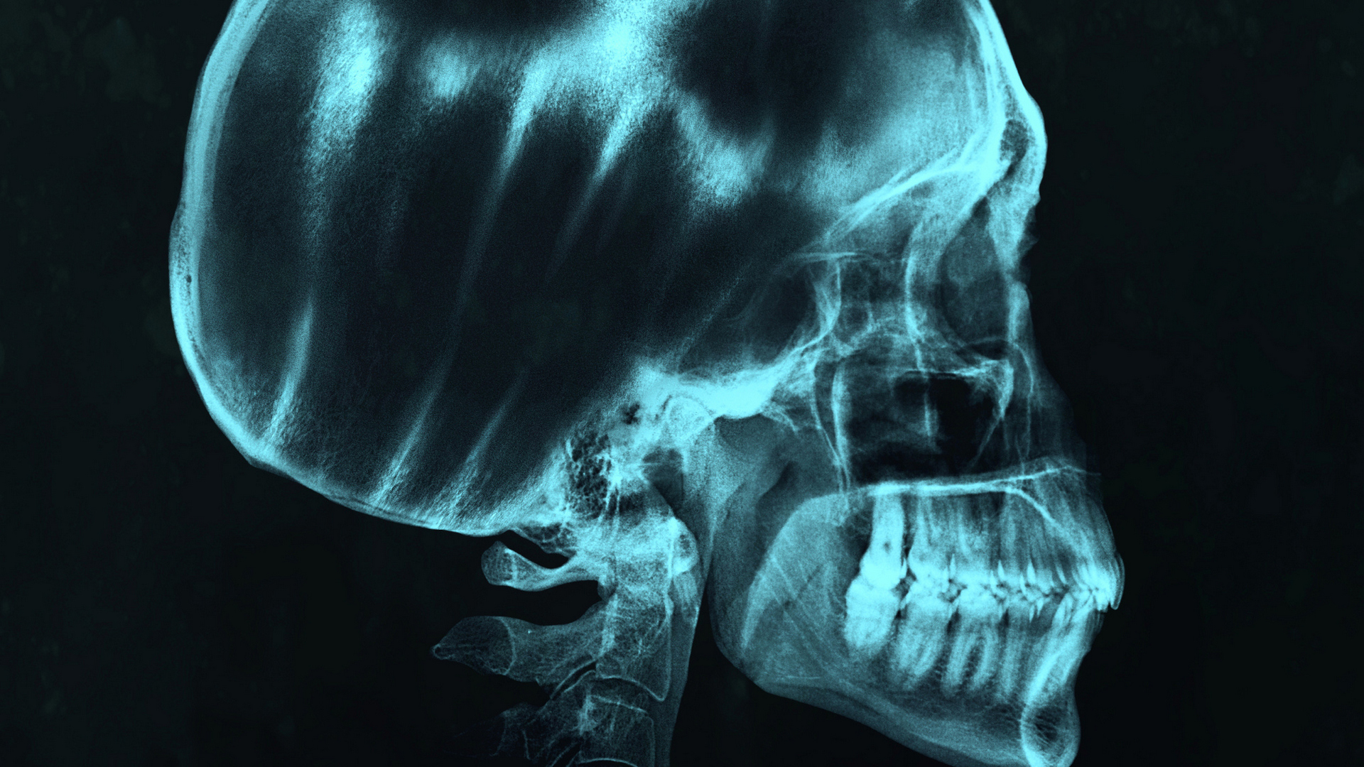 13 клиническая