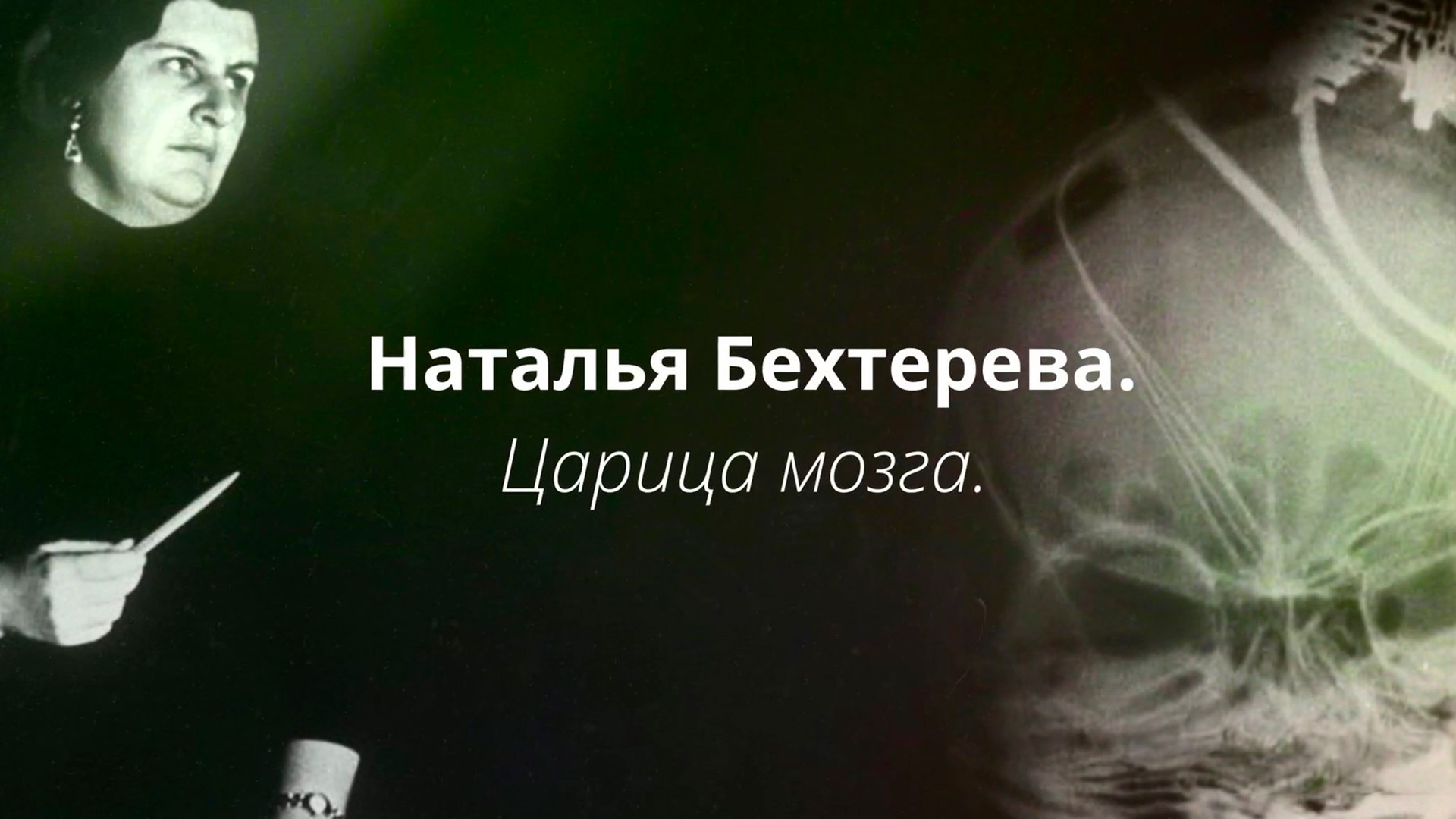 Царица мозга
